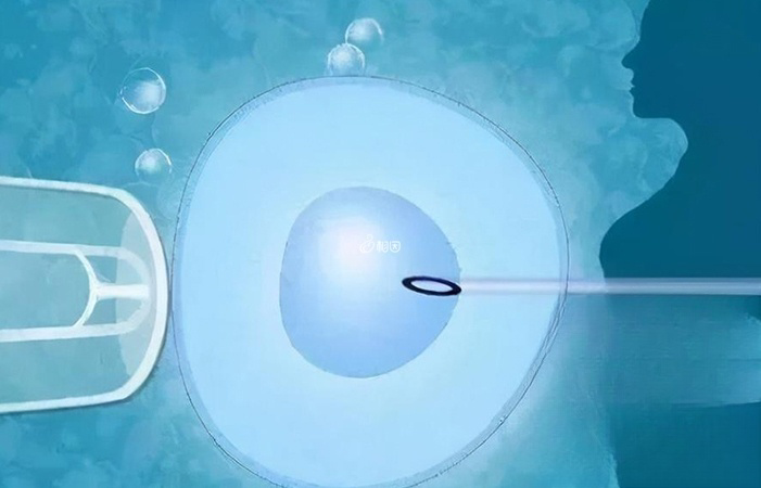 胚胎移植后女性可以通过运动提高胚胎着床率