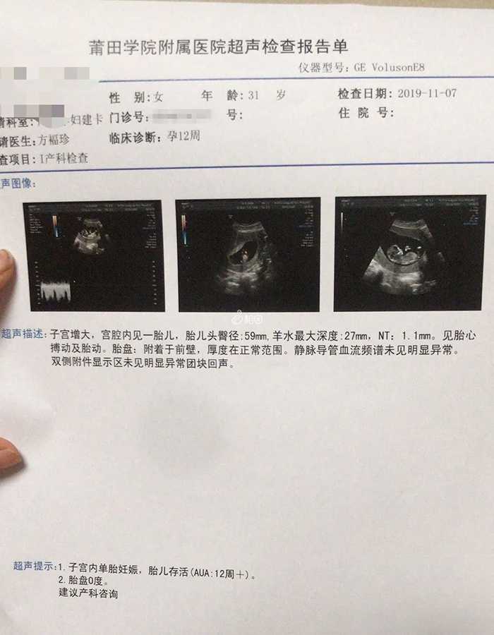 怀孕3个月的B超结果