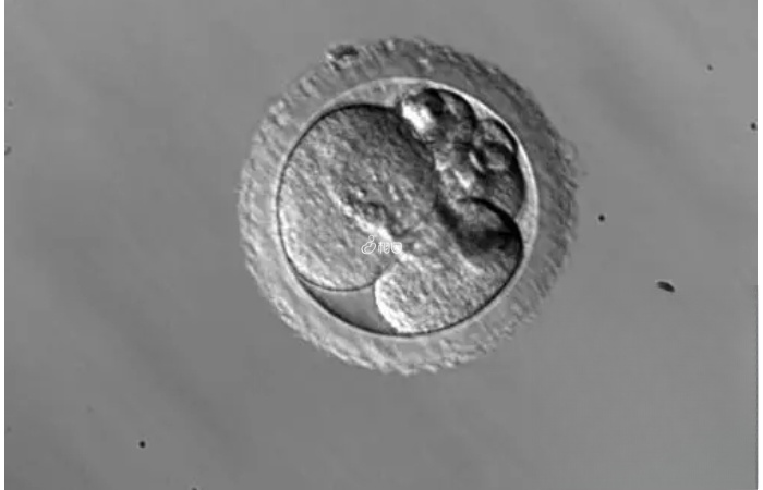 三代试管婴儿筛选出胚胎嵌合体的原因有三个