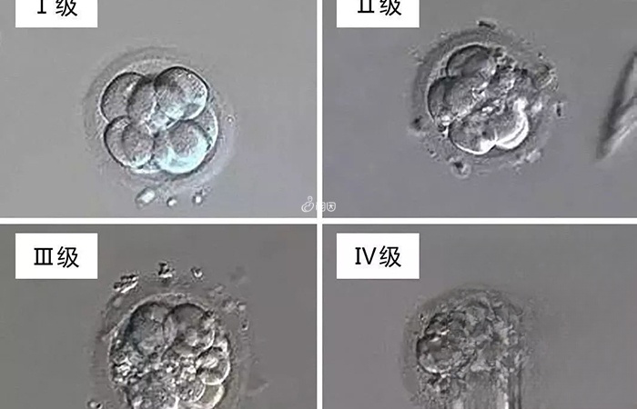 囊胚移植后从第一天到第十四天会经历很多