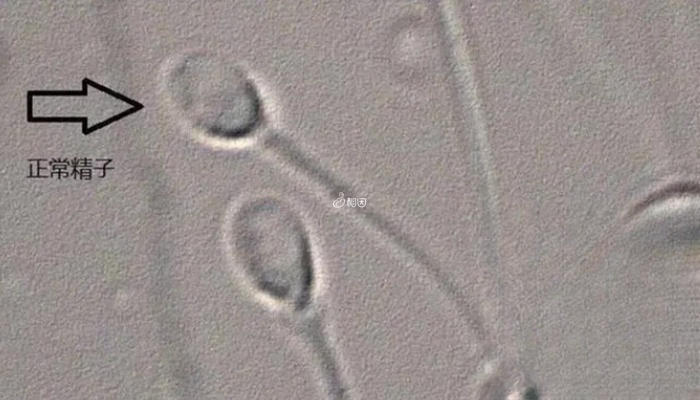 IMSI精子筛查技术在6000倍显微镜下进行