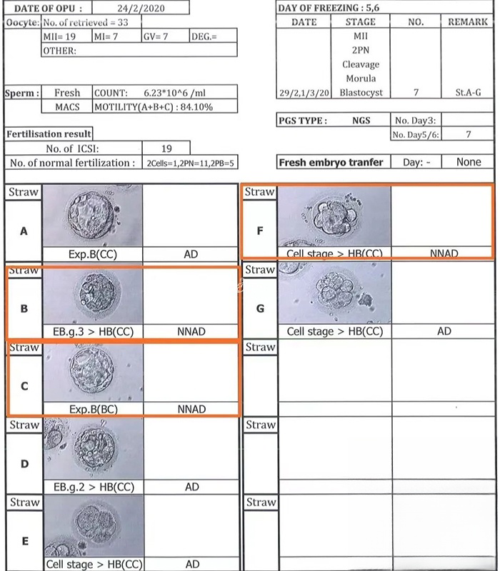 7个囊胚三个筛查正常