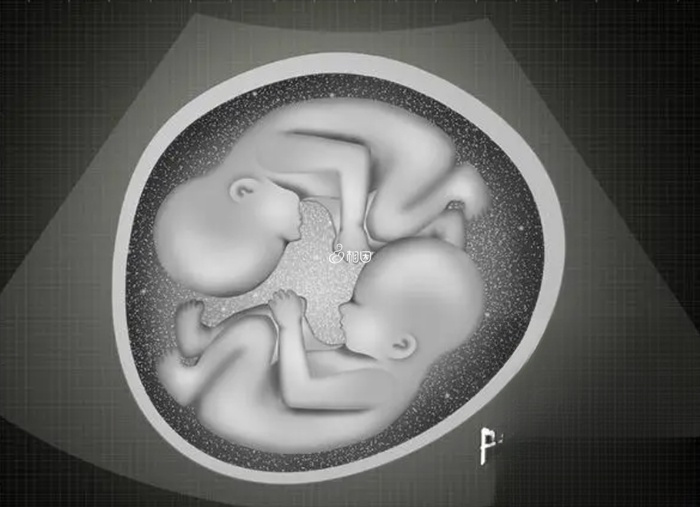 调理好子宫才能进行双胚移植