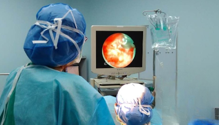 宫腔镜手术操作技巧不足可能引发内膜炎