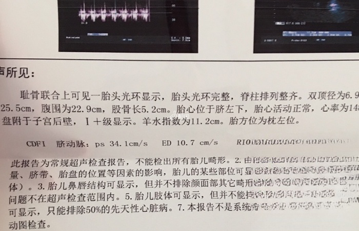 脐动脉sd值大于3怀的男孩