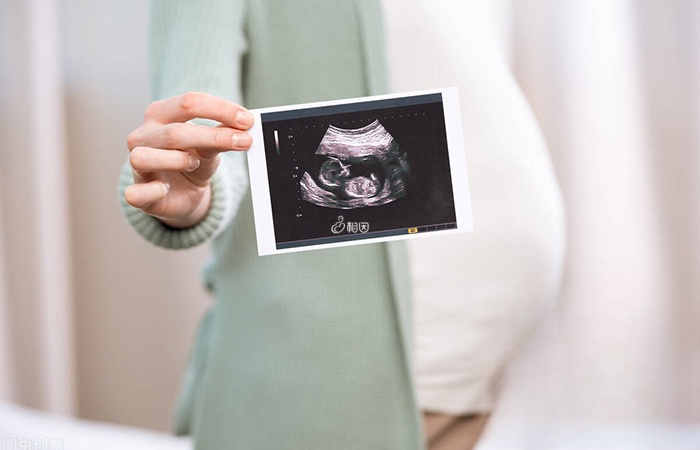 医生会根据早孕期的孕囊大小来推算孕周
