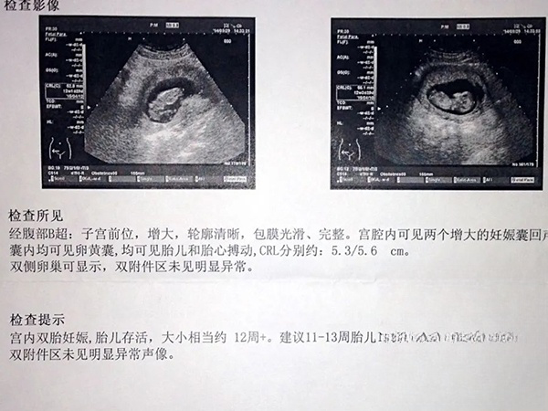 B超好孕的结果