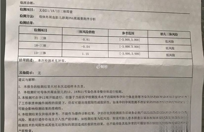 在上海市做一次无创DNA检查的价格不高