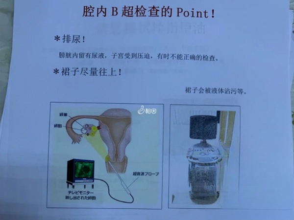 复查B超注意事项