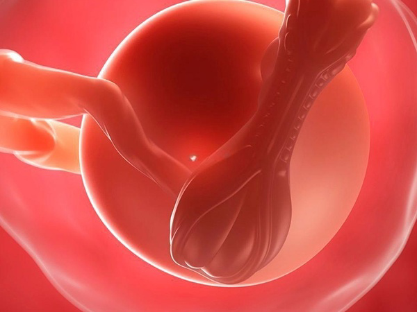 子宫畸形可能会导致胎位异常