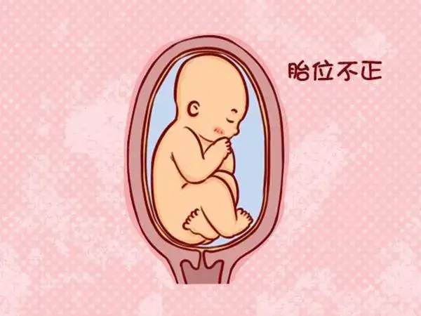 胎儿在子宫里的位置并不固定