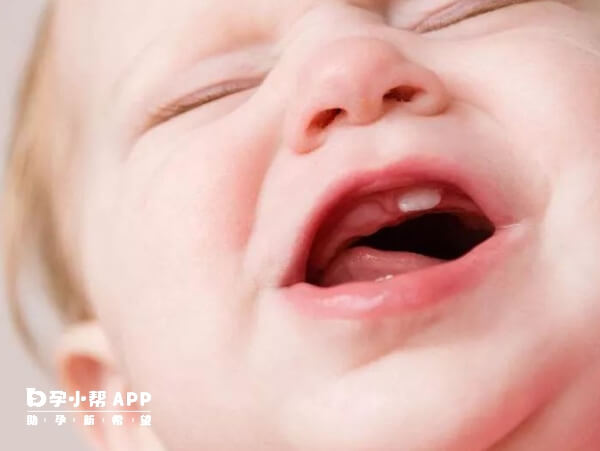 宝宝出生后1年内会萌出第一颗乳牙