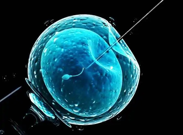 试管婴儿又称体外受精-胚胎移植