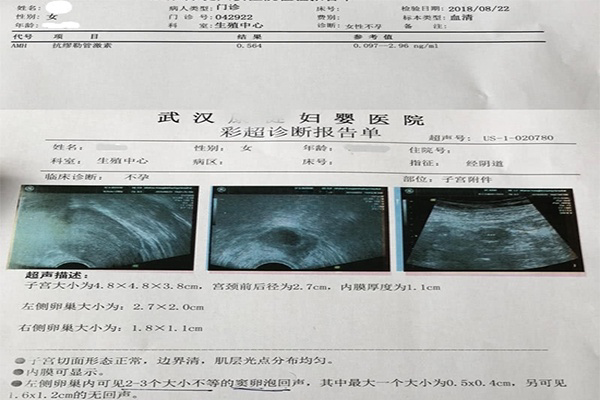 再做二维彩超，详细了解