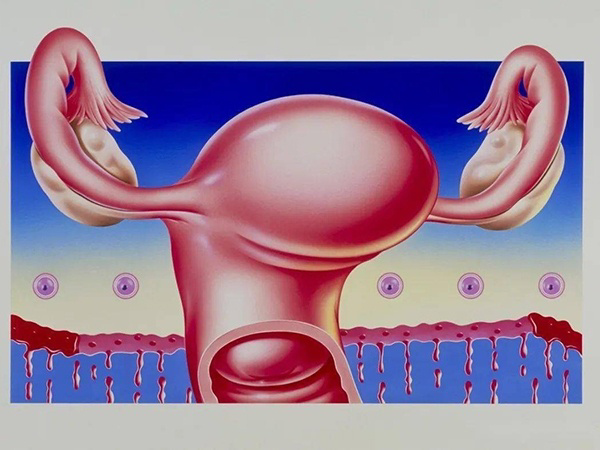 子宫内膜癌患者禁忌使用人工周期治疗