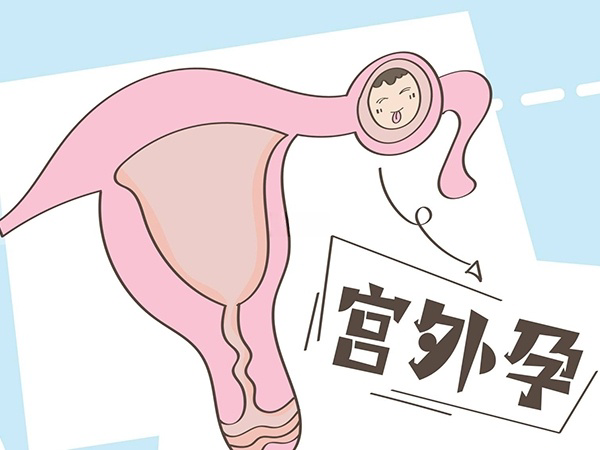 输卵管切除后宫外孕几率增加