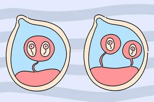 龙凤胎本质是形成两个受精卵