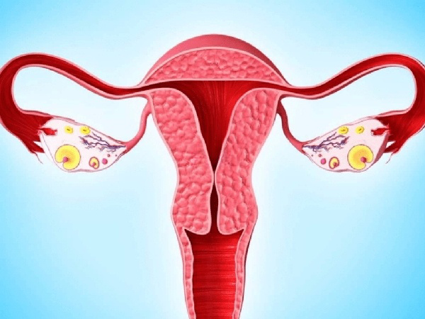 子宫内膜异位症容易无法正常生孕