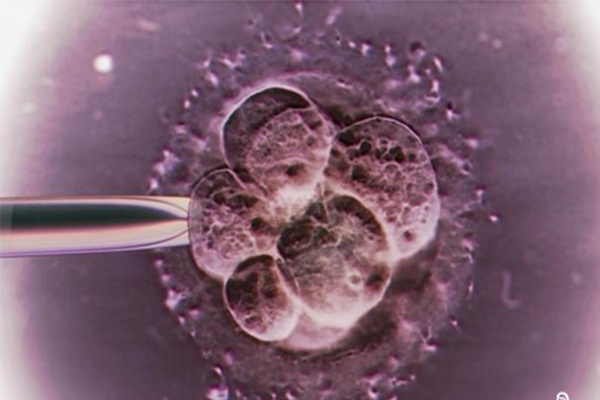 培养皿中精子与卵子自由结合