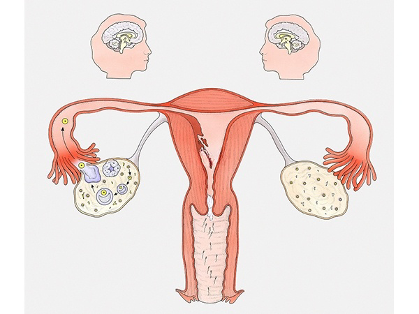子宫内膜厚度随周期的变化而变化