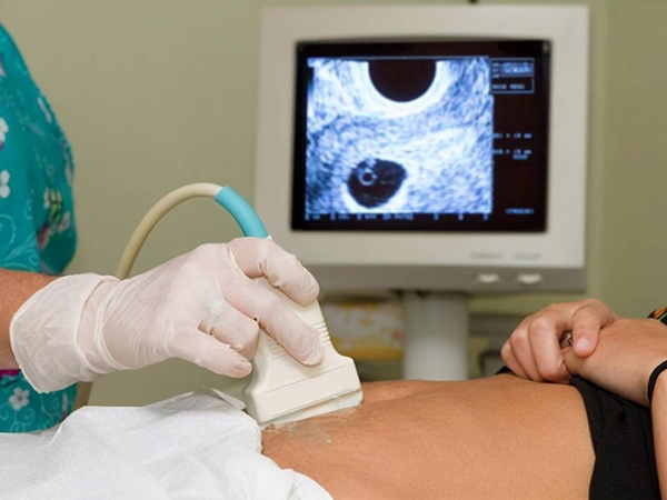 nt检查就是胎儿颈后透明带检查