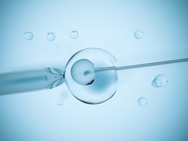 第一代试管婴儿即IVF—ET3