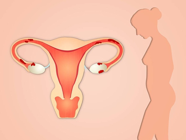子宫出现异常会对胎儿的发育造成影响