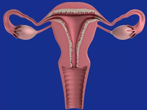 幼稚子宫常伴有卵巢发育不良