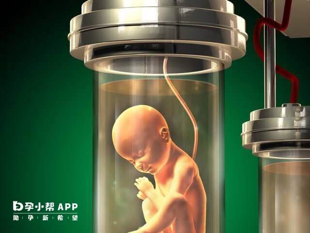 无子宫不可利用人造子宫术人工受孕