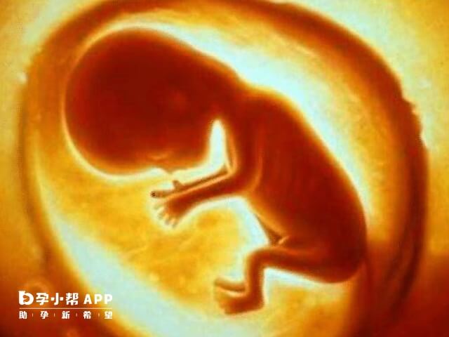子宫内胎盘小会导致二胎臀位