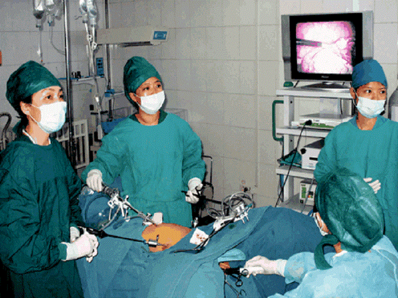 输卵管造影手术过程