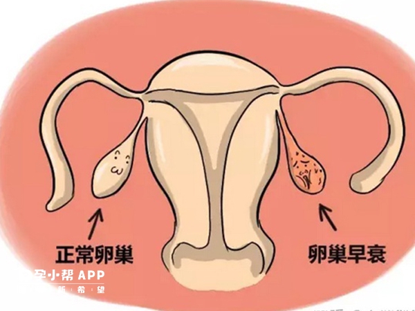 定坤丹有改善卵巢早衰的作用