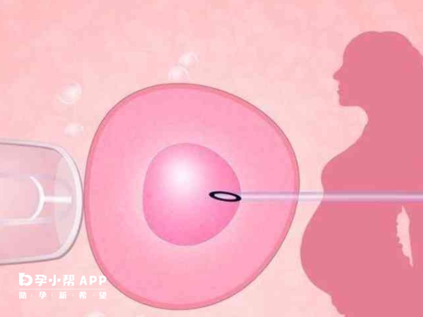 积极配合医生可以保证试管一次成功