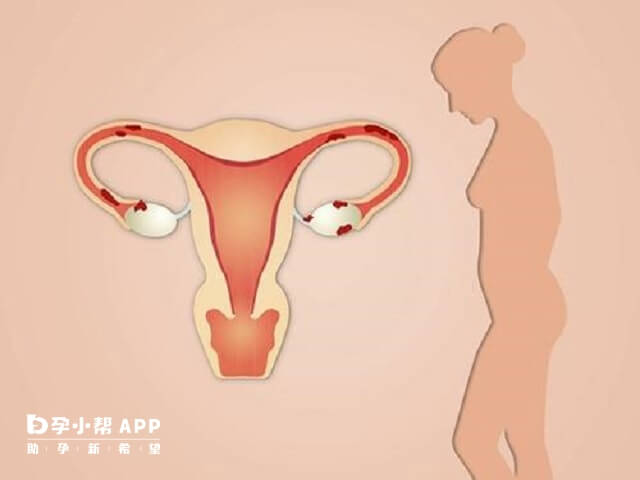 子宫内膜厚会影响怀孕