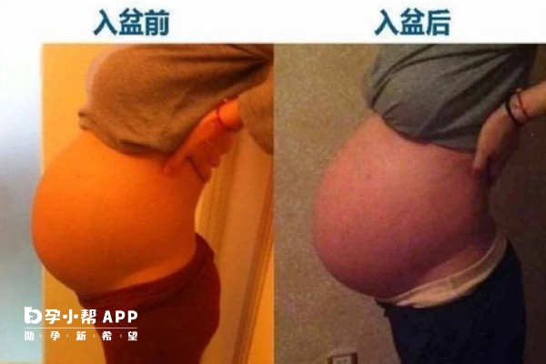 孕晚期胎儿入盆后对比