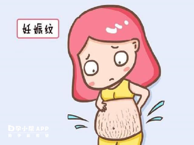 妊娠纹的样子